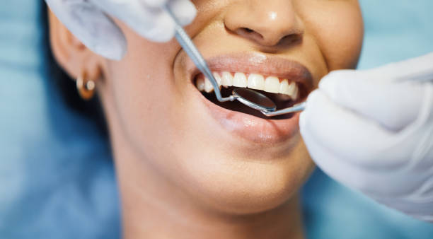 Best Emergency Cosmetic Dentistry in Fremont, CA